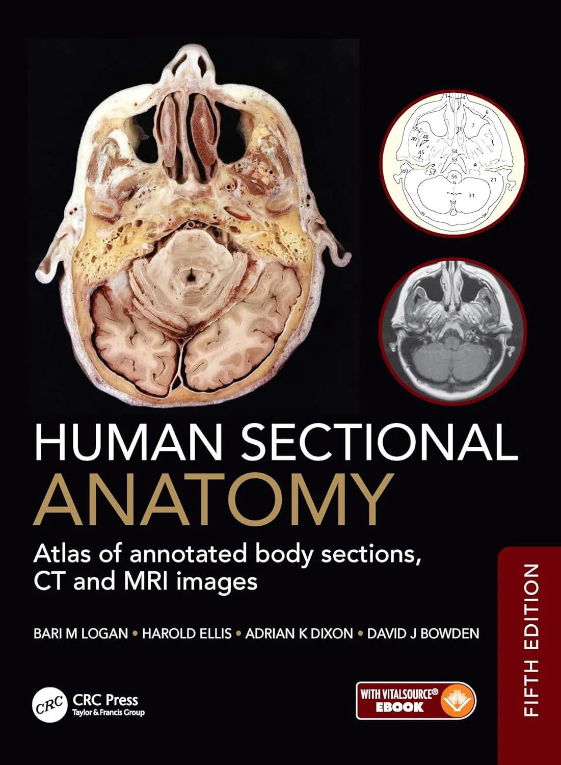 Human Sectional Anatomy: Atlas of Annotated Body Sections,CT and