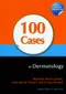 100 Cases in Dermatology
