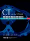 胸部電腦斷層攝影(胸部CT /Medical Sciences)
