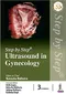 *Step by Step Ultrasound in Gynecology